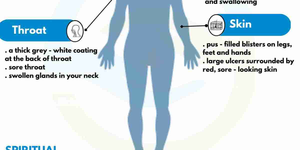 Holistic Diphtheria Treatment with Homeopathy in Hyderabad – Spiritual Homeopathy