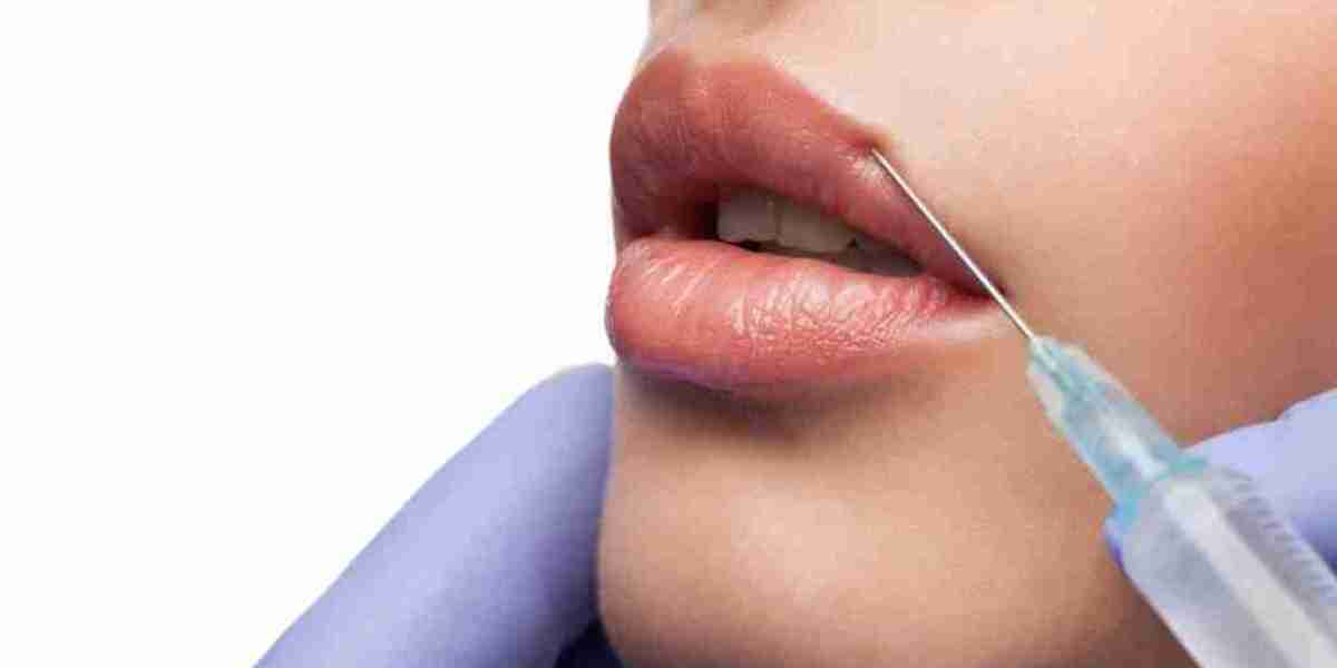 Lip Filler Market Expands as Younger Demographics Seek Custom Cosmetic Enhancement Solutions