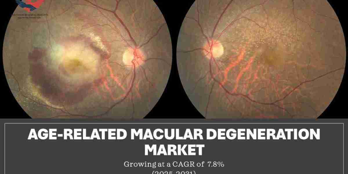 Age-related Macular Degeneration Market Size, Share, Trends, Growth 2031