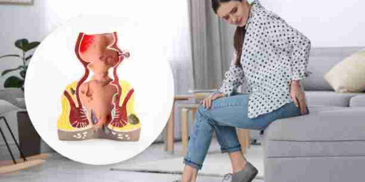 Top-Rated Hemorrhoid Treatment in Riyadh – Book Today