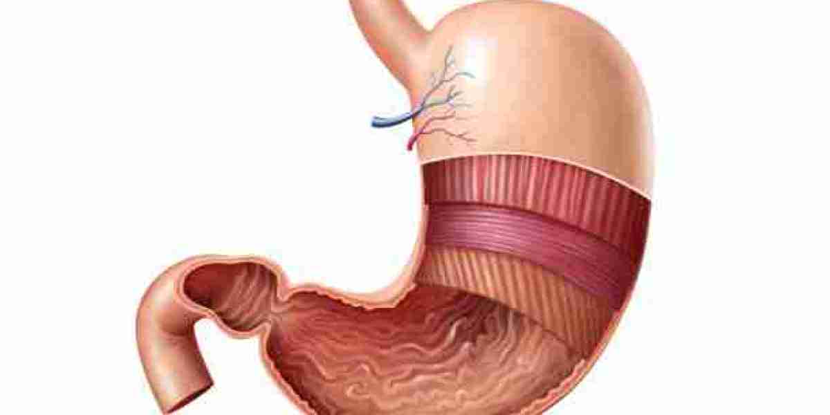 Expert Gastric Balloon Riyadh Advice