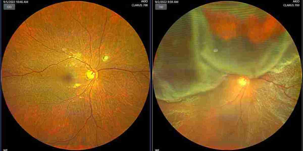 Top Eye Specialist in Delhi NCR: Ensuring the Health of Your Vision