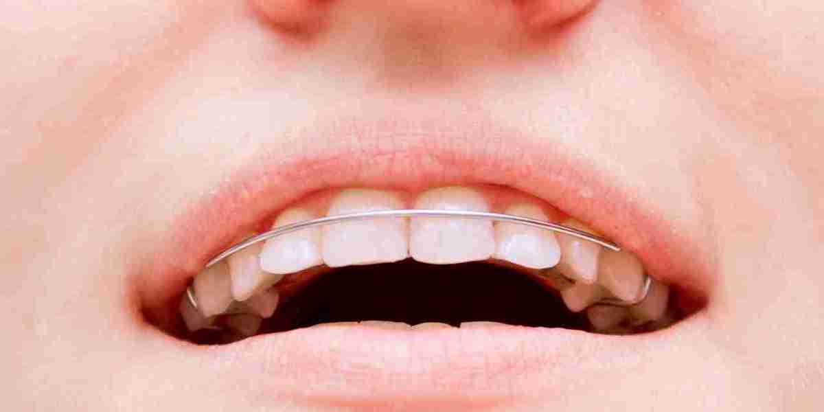 How to Store Your Retainer Properly?