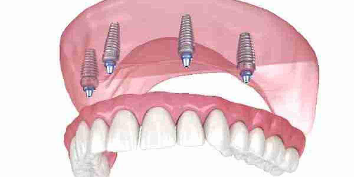 Local Experts Committed to Your Smile in Dunstable