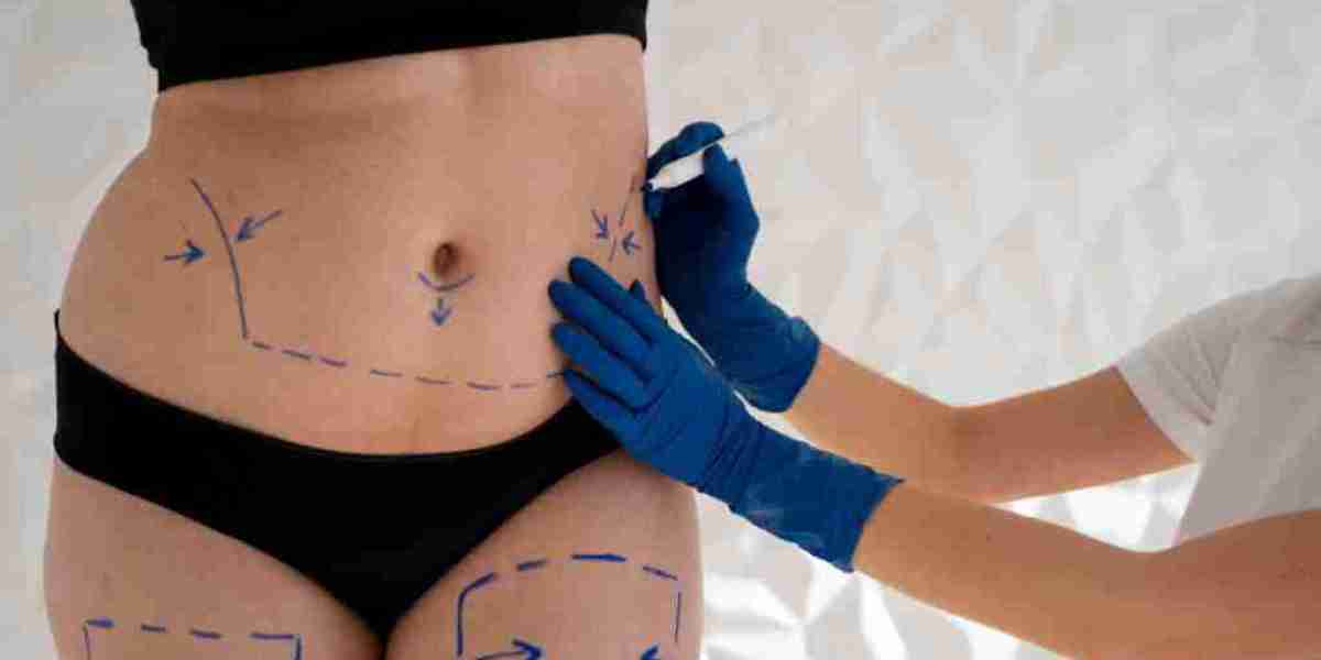 Liposuction Surgery in Delhi | Liposuction Surgery Cost in Delhi