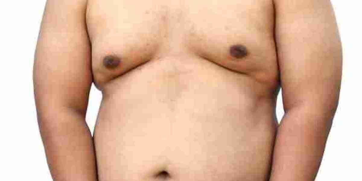 Risks of Gynecomastia in Riyadh: Understanding Your Options