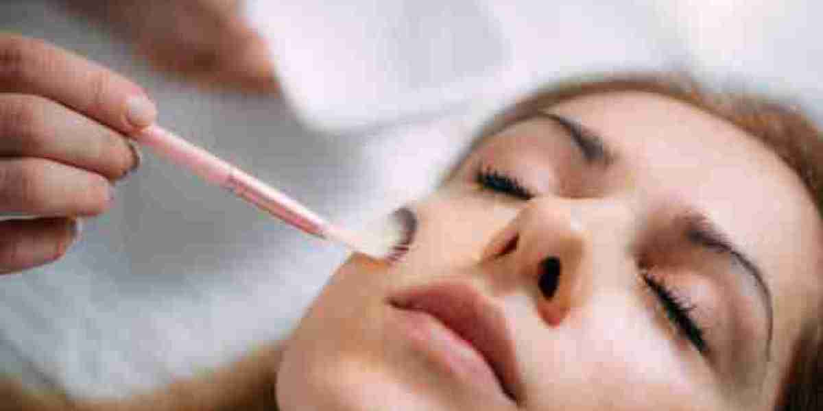 Advanced Chemical Peels Riyadh: Unveiling Your Skin's Potential