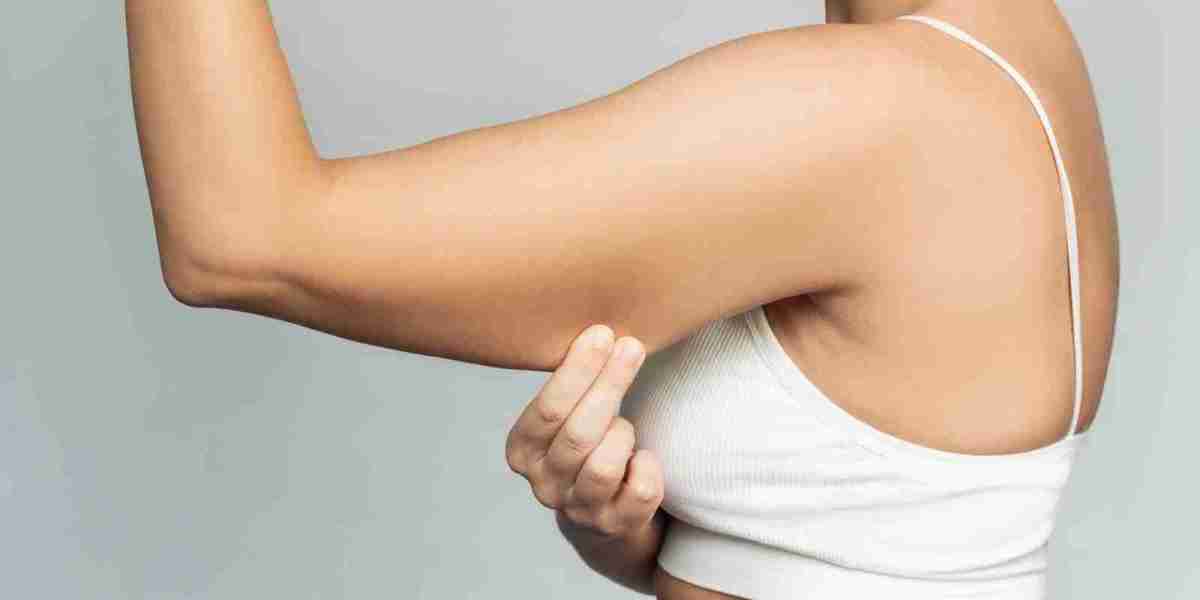 The Complete Guide to Brachioplasty Recovery