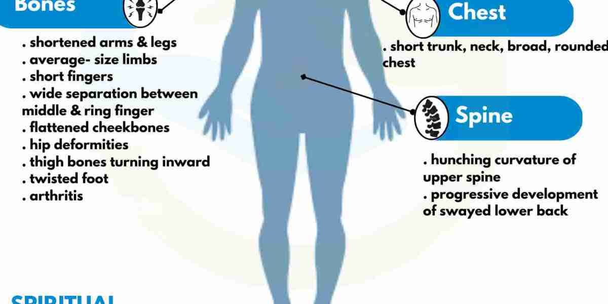 Trusted Homeo Doctor in Hyderabad for Dwarfism – Spiritual Homeopathy