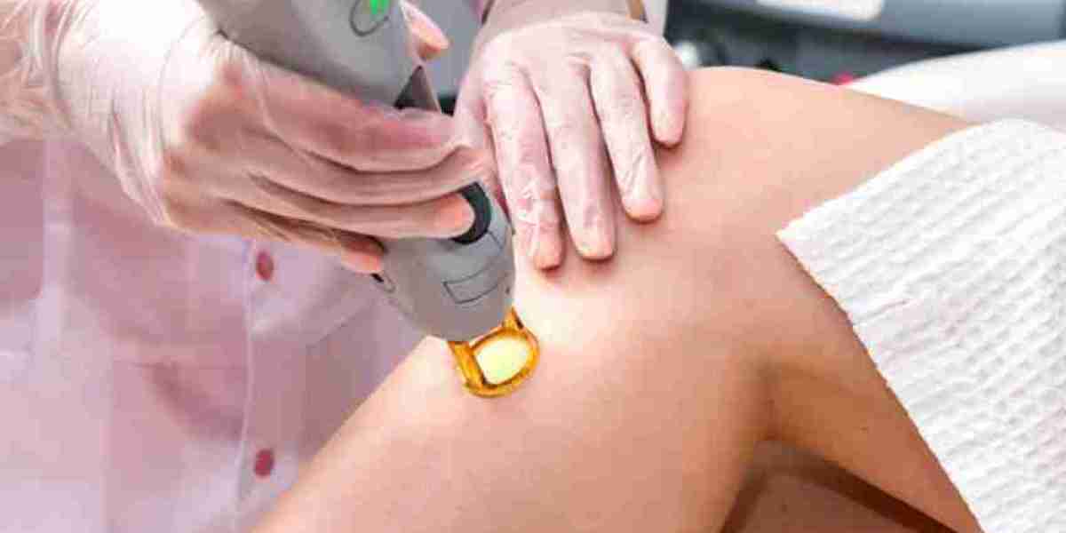 Can I Get Laser Hair Removal While Pregnant?