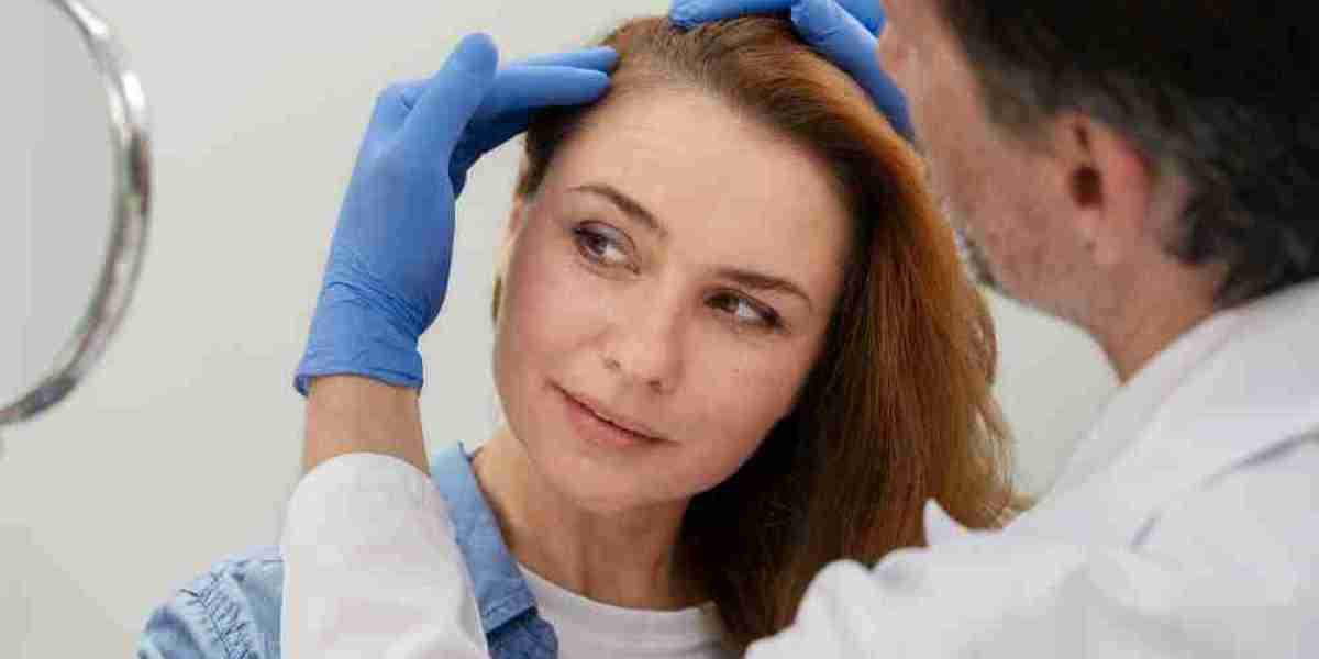 Choose the best Hair loss treatment!