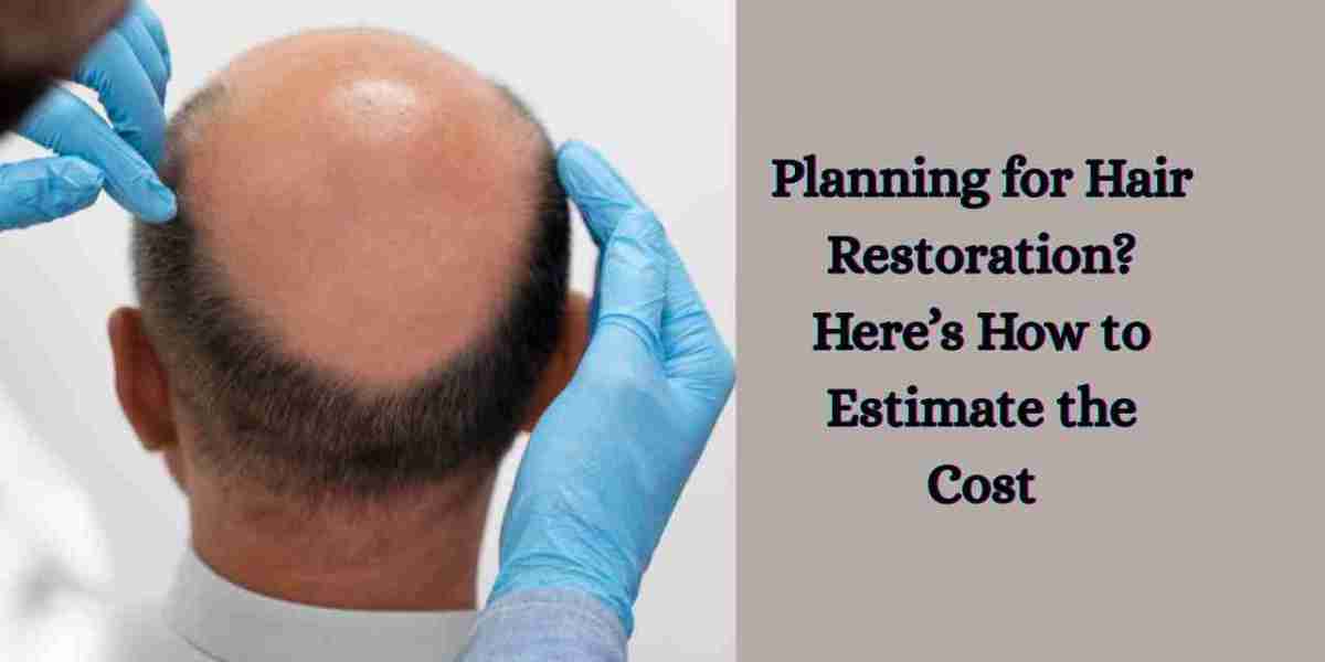 Planning for Hair Restoration? Here’s How to Estimate the Cost