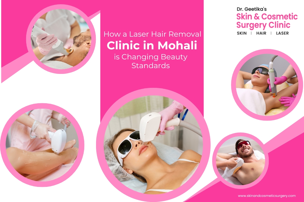 Smooth Skin, Modern Standards: Laser Hair Removal in Mohali