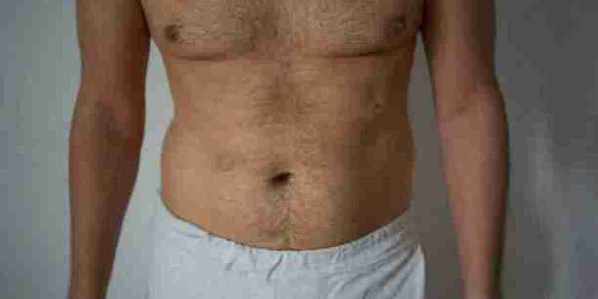 Affordable Gynecomastia Surgery in Riyadh