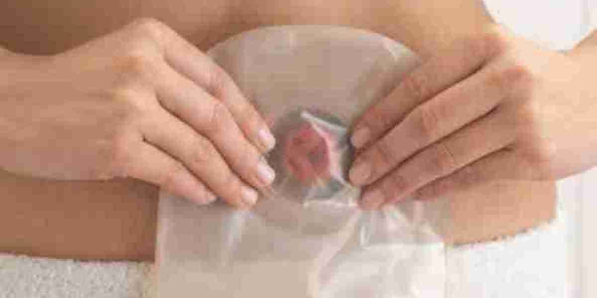 OstomyStoma Care Market Research Indicates Rising Demand for Advanced and Personalized Medical Solutions