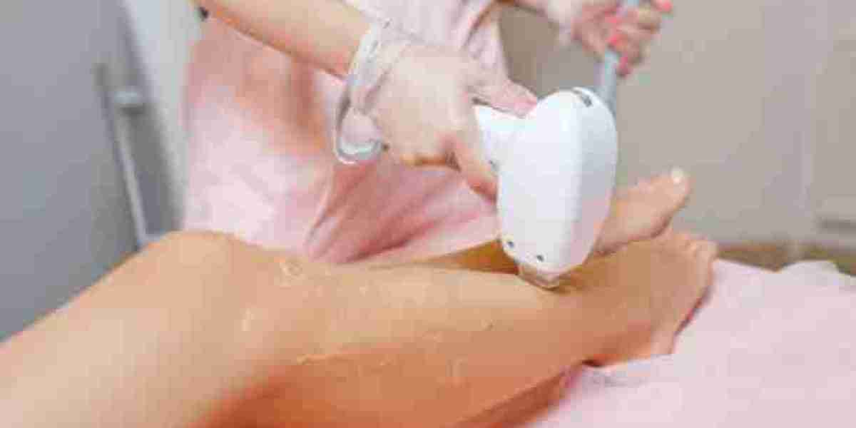 Laser Hair Removal for Men in Riyadh: Everything You Need to Know