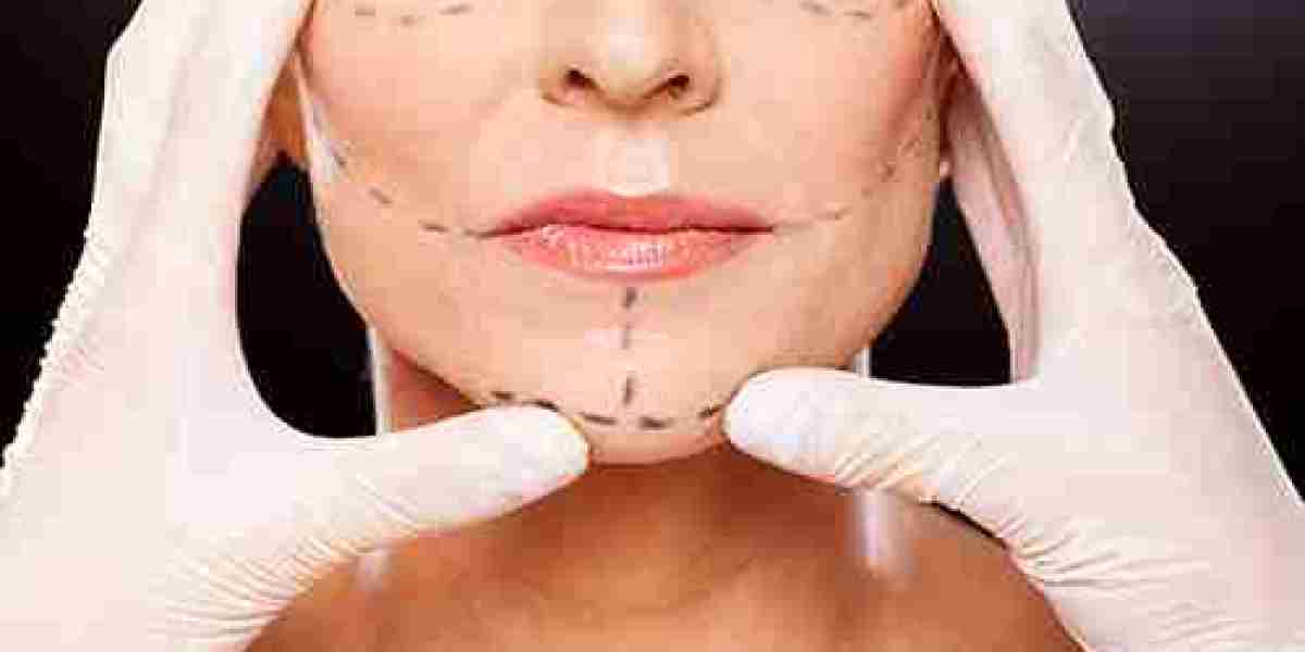 What Happens During a Facelift Consultation?