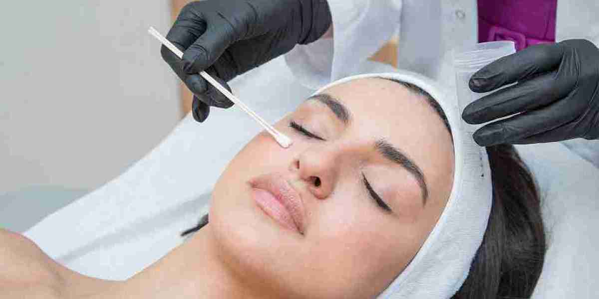 Chemical Peels for Minimizing the Look of Scars