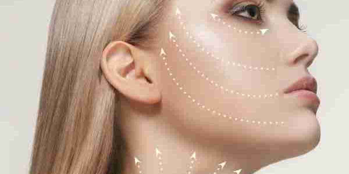 Understanding Facelifts and Their Modern Appeal