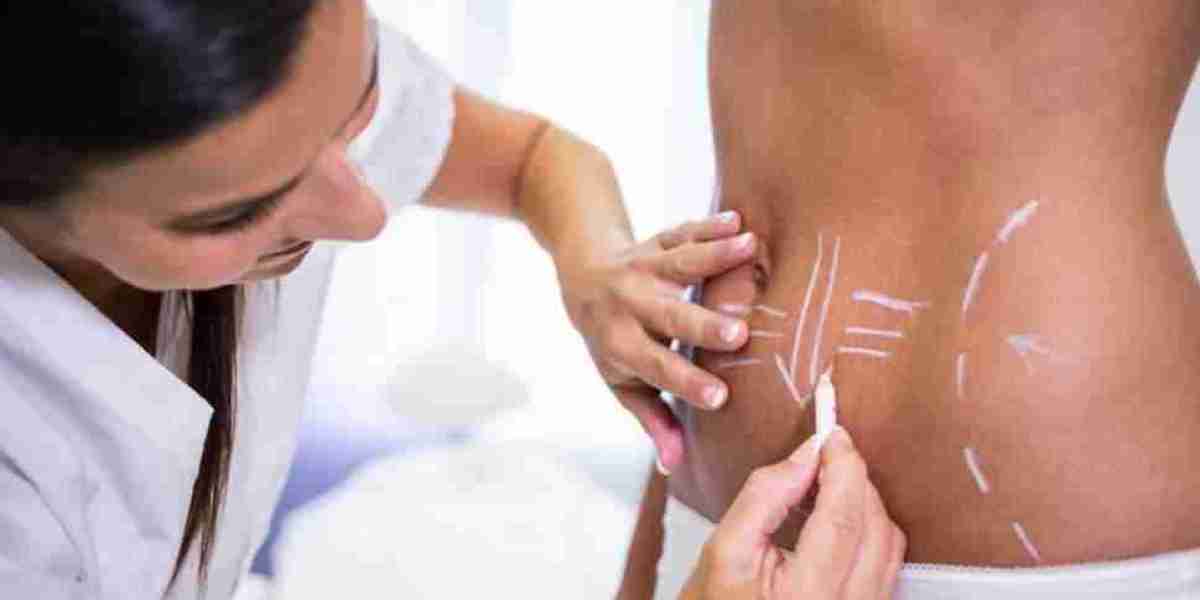 Popular Surgical Body Shaping Solutions in Islamabad