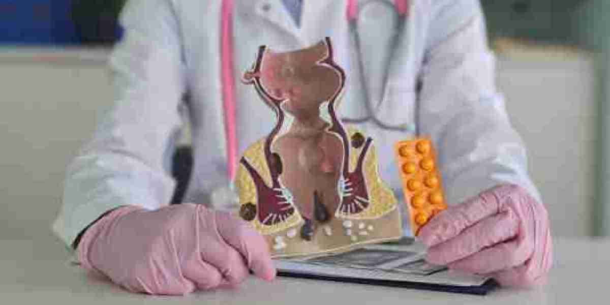 How to Treat Hemorrhoids in Riyadh
