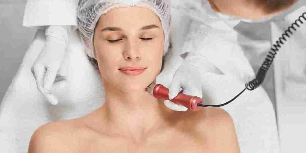 Trusted Micro Needling Treatment in Whangaparaoa by Skin Renew