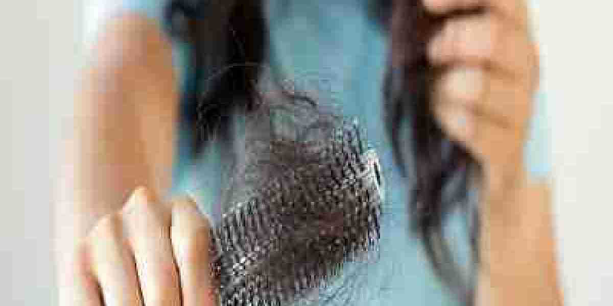 Advanced Laser Therapy for Hair Loss in Islamabad: Is It Right for You?