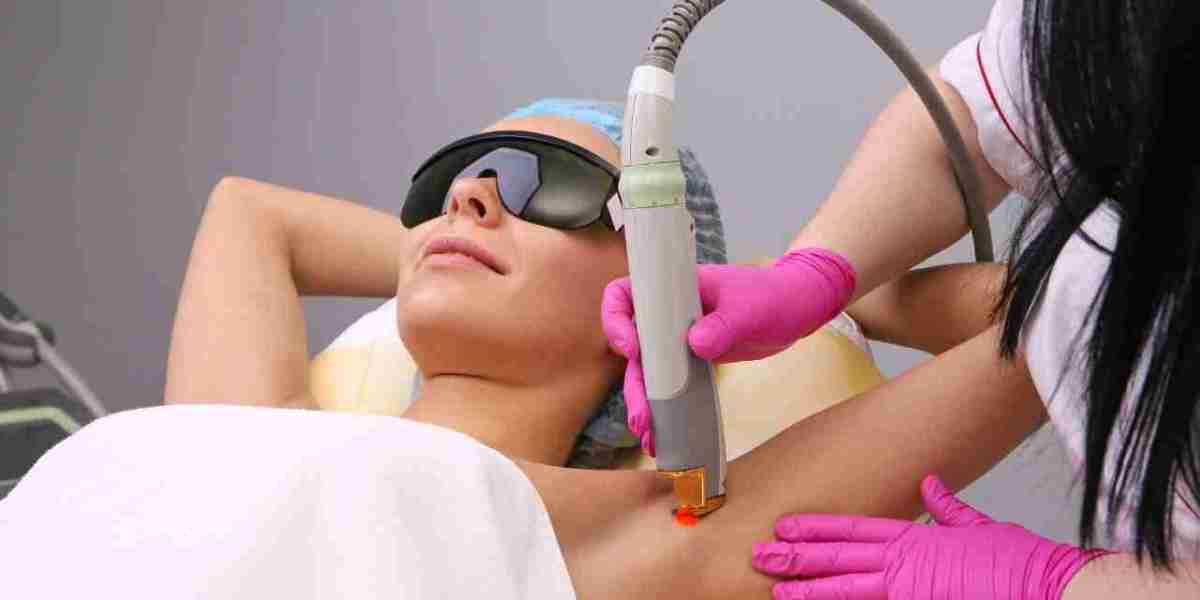 Are there any side effects of laser hair removal?