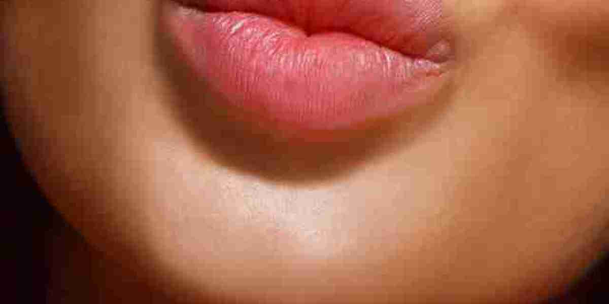 Hidden Costs to Watch for with Lip Injections