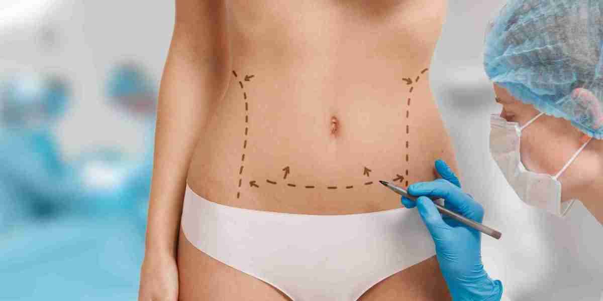 Riyadh Tummy Tuck: Pricing and Financing Options