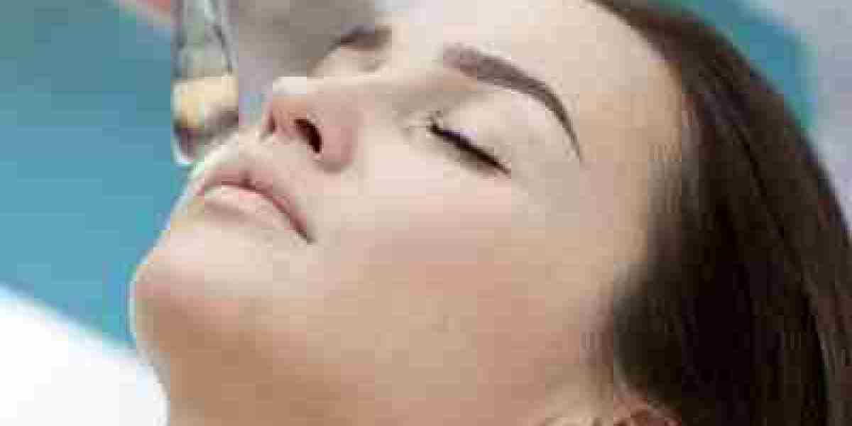 Is Melasma More Common in Expats Living in Dubai?