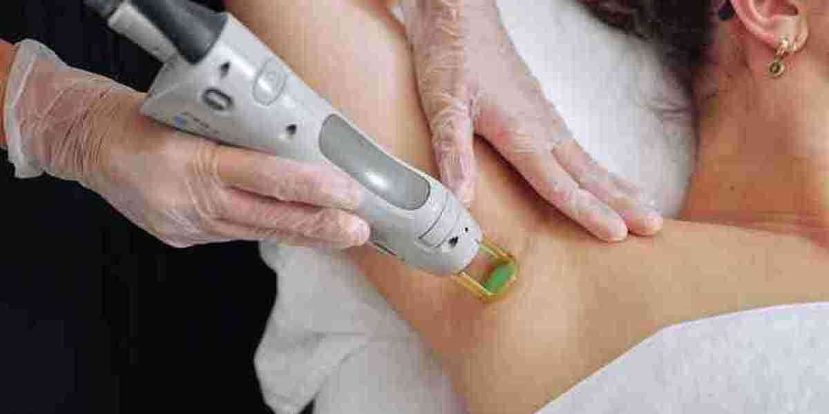 Laser Tattoo Removal: How Much Does It Hurt