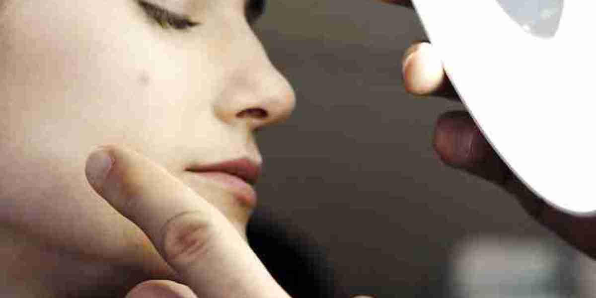 Acne Treatment: Dermatologist in Riyadh Offers Clear Skin Solutions