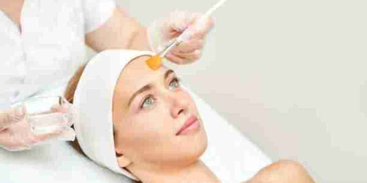 Achieve Flawless Skin with Chemical Peels in Riyadh