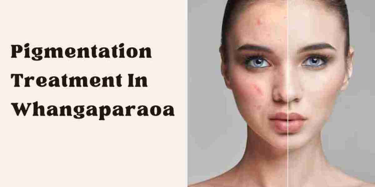 Pigmentation Treatment in Whangaparaoa: What to Expect at Skin Renew