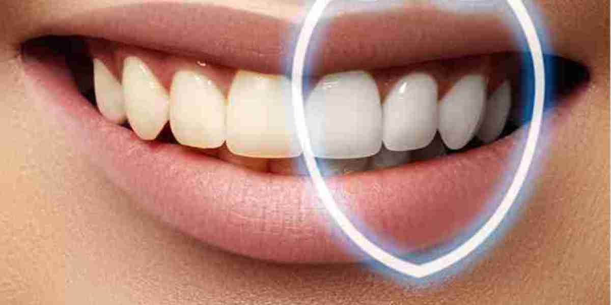 Teeth Desensitizer Market Sees Demand Surge with E-commerce and Natural Product Advancements
