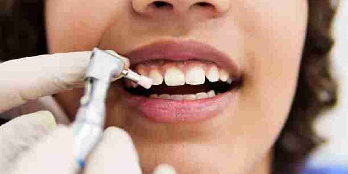 Teeth Cleaning for Kids Riyadh: What's Involved?