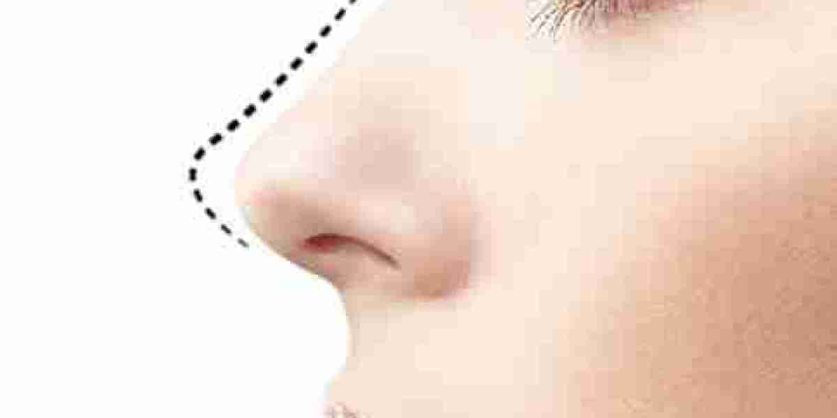 What’s the Difference Between Open and Closed Rhinoplasty in Dubai?