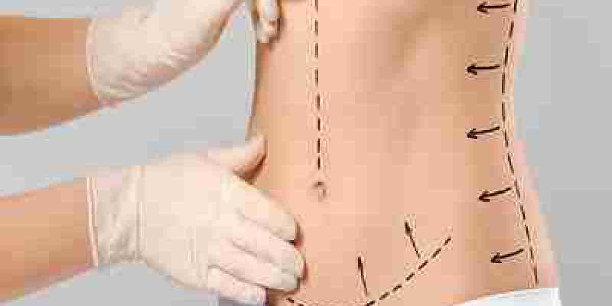 What Happens If I Gain Weight After a Mini Tummy Tuck in Dubai?