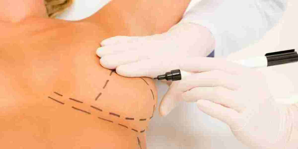 Breast Reduction Risks & Benefits in Riyadh