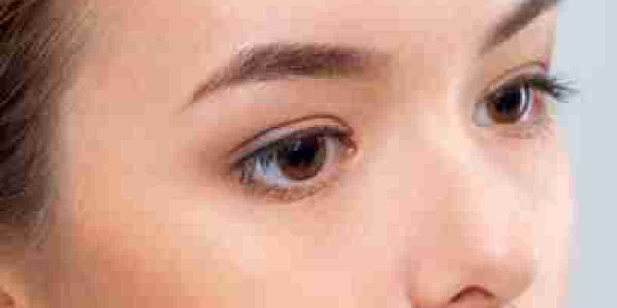 Alarplasty in Riyadh: Minimally Invasive Techniques Explained