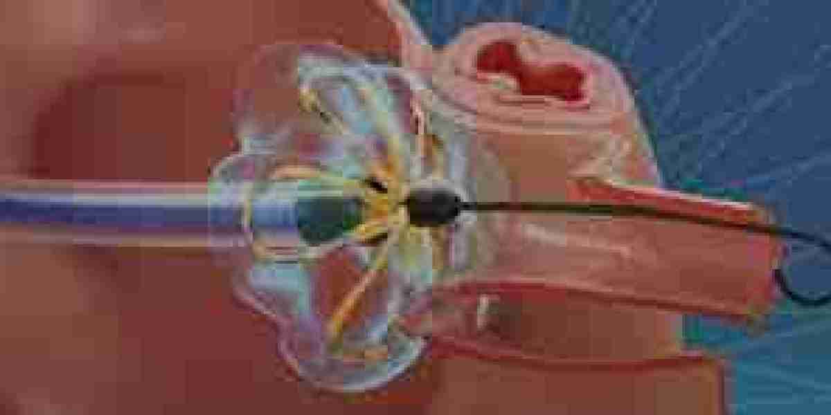 Atrial Fibrillation Device Market Development: Innovations, Growth Drivers, and Future Outlook