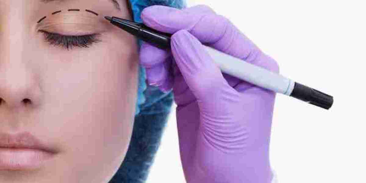 Riyadh Plastic Surgery: FAQs Answered for Your Transformation Journey