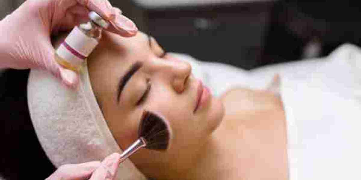 Chemical Peels in Riyadh for Hyperpigmentation
