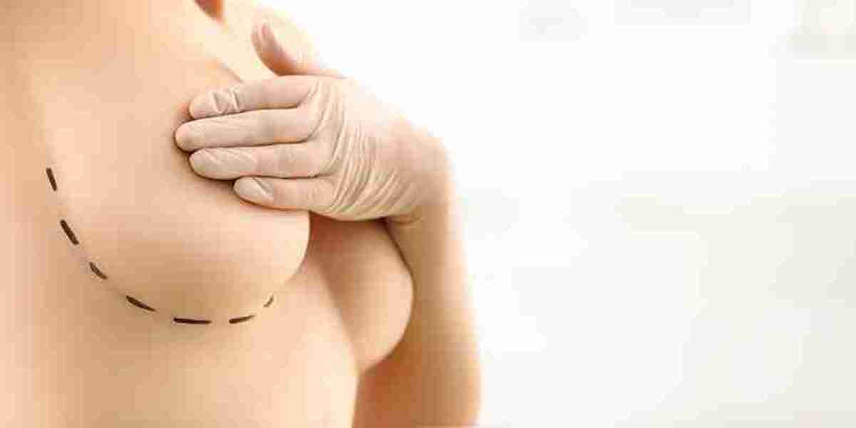 Understanding the Cost of Breast Reduction in Dubai