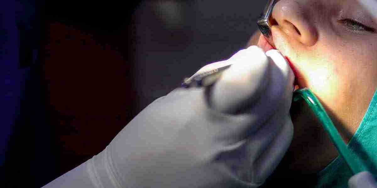 Does Root Canal Cause Illness? The Truth Explained