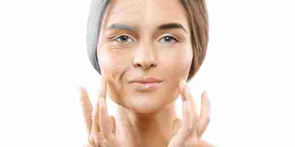 Are Anti-Aging Treatments in Dubai Permanent or Will My Wrinkles Return?