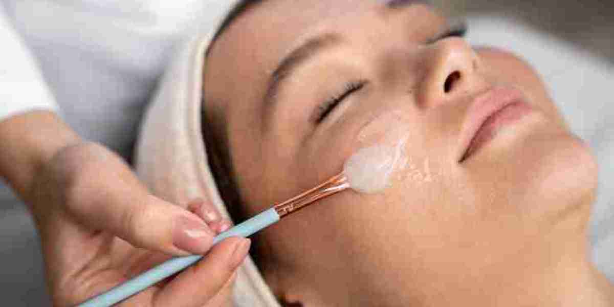 Can I Go Out in the Sun After a Peel?