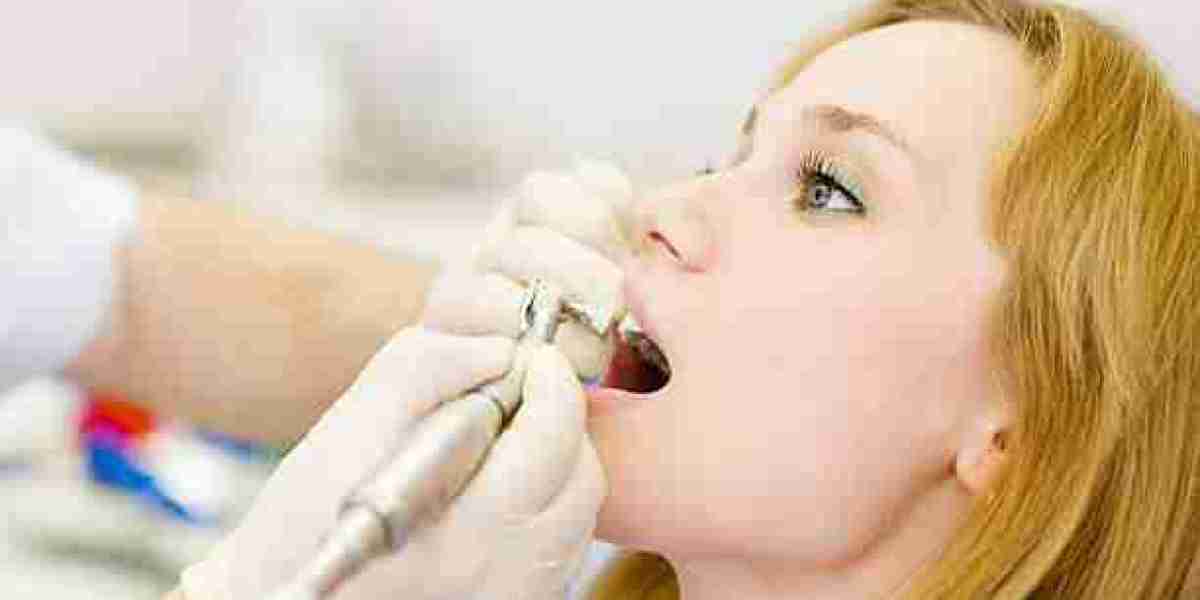 Riyadh: Aftercare for Teeth Cleaning Sessions?