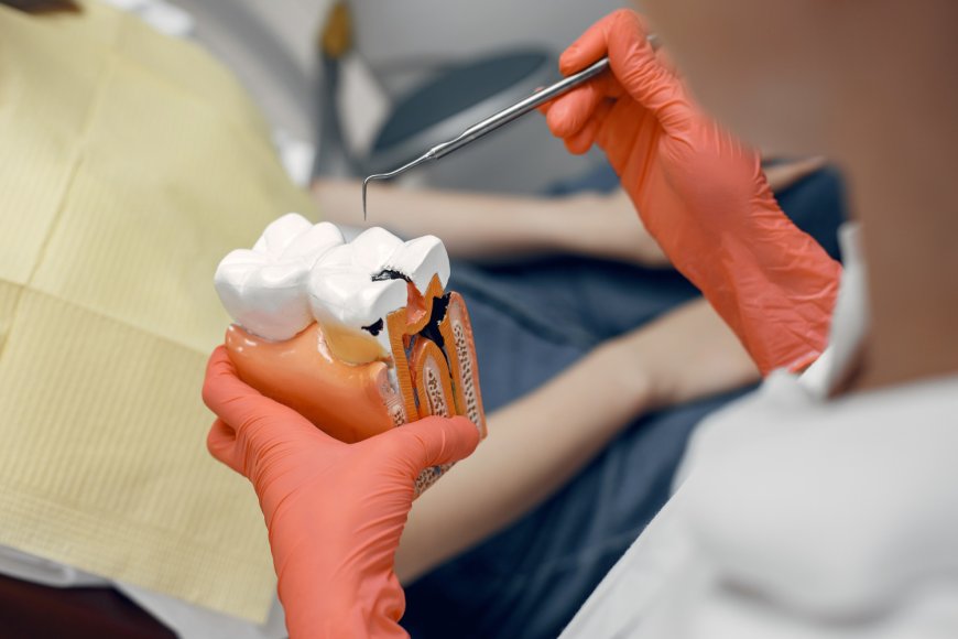 Smile Savers: Your Ultimate Guide to Root Canal Treatment UAE - Bip San Francisco